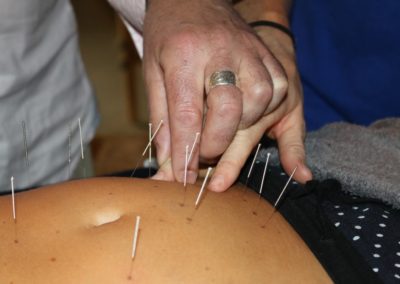 Kangfu Seminars Europe | Abdominal Acupuncture