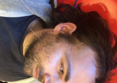 Glaucoma extra points | Kangfu Seminars