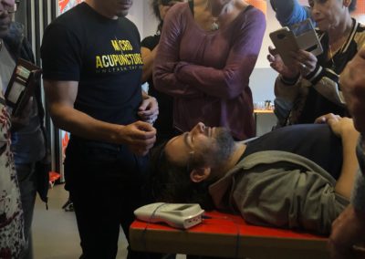 Needling demonstrations | Kangfu Seminars