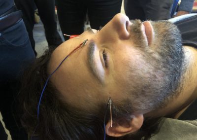 E-stim demonstration | Kangfu Seminars